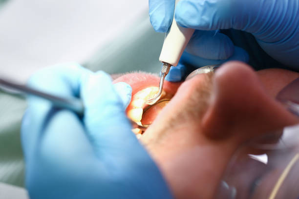 Best Emergency Tooth Extraction in Sherman, TX