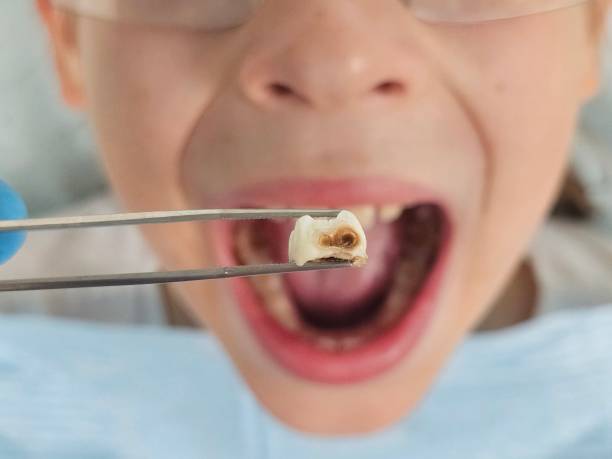 Best Cosmetic Emergency Dentistry in Sherman, TX
